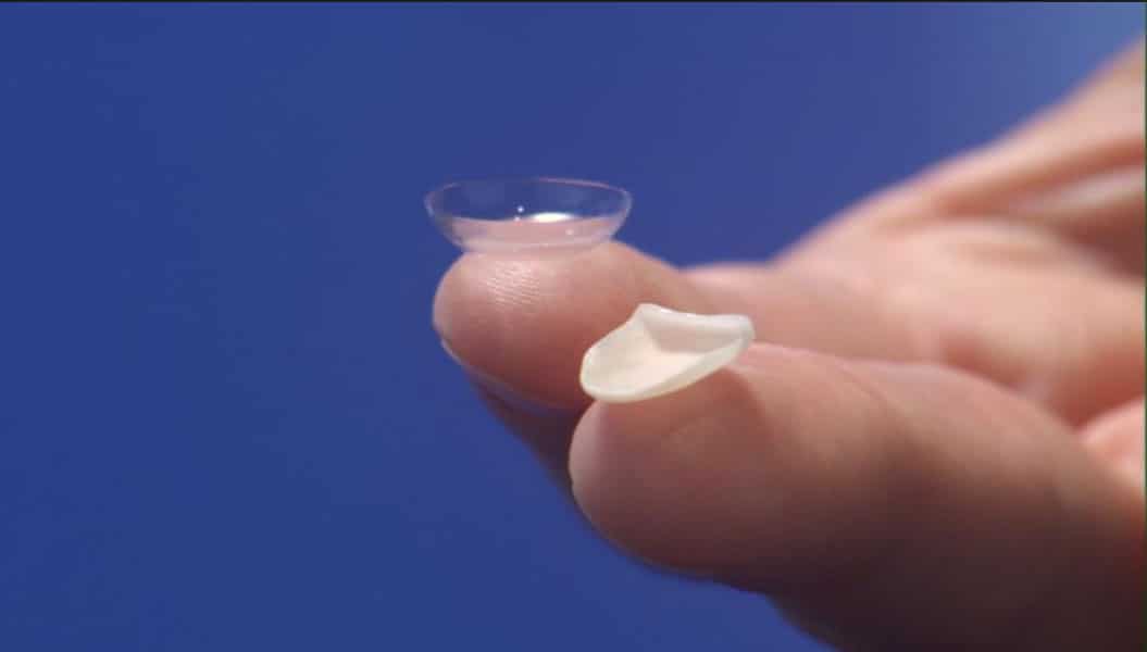 Closeup of Porcelain Veneers